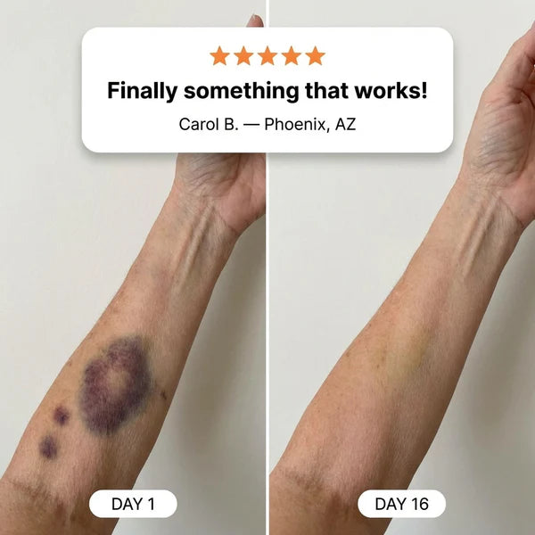 Buy 1 get 1 Free💥100K+ SOLD💕- NESLEMY® Bruise Repair & Skin-Strengthening Cream